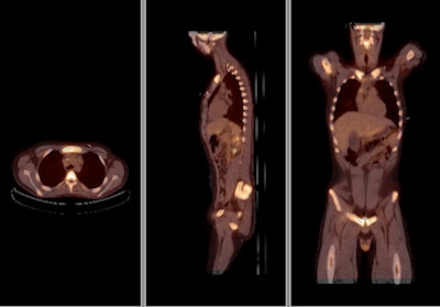 2009 08 12 13 10 11 602 Pet Market Philips Top B 394