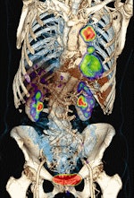 2009 08 12 13 20 31 635 Pet Market Siemens Torso 150