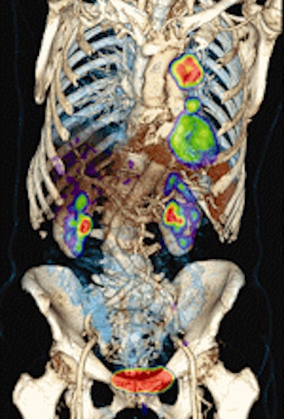 2009 08 12 13 20 31 635 Pet Market Siemens Torso 150