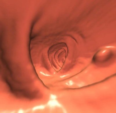 2009 08 13 14 09 49 181 Pickhardt 7mm Sup120 bottom