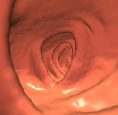 2009 08 13 14 09 51 70 Pickhardt 7mm Sup90 top