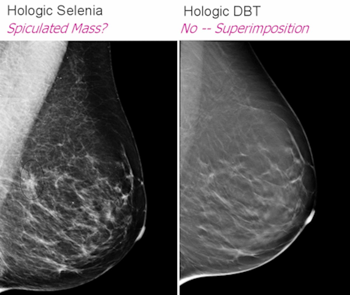 Breast imagers, ahoy: New technology on the horizon | AuntMinnie