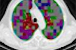 2009 08 19 14 04 27 769 Azevedo thumb 08 09