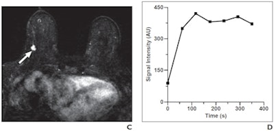 2009 08 20 13 43 44 371 Figure1 Cd 450