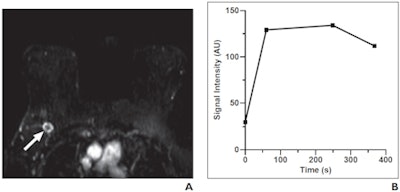 2009 08 20 13 43 45 581 Figure1 Ab 450