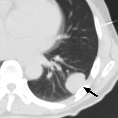 2009 08 28 13 21 50 443 09 08 2298 04a 394