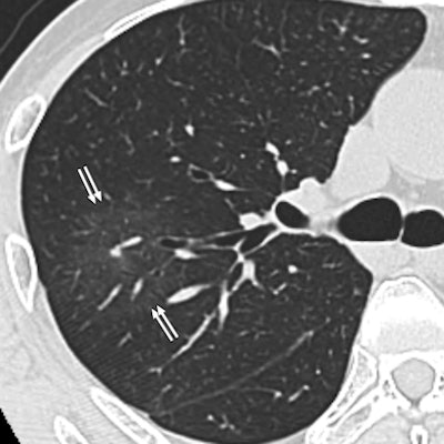 2009 08 28 13 21 53 972 09 08 2298 02b 394