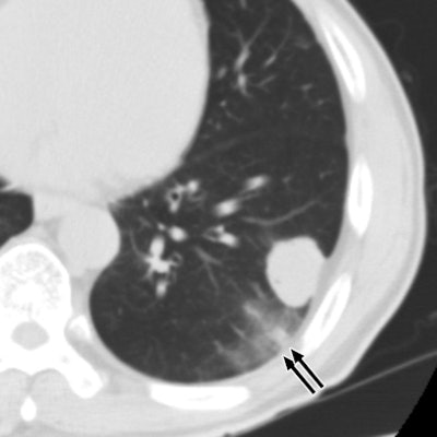 2009 08 28 13 21 55 996 09 08 2298 04b 394