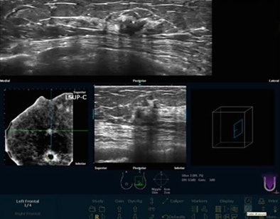 2009 08 31 09 03 40 6 Chang 3viewsbottom