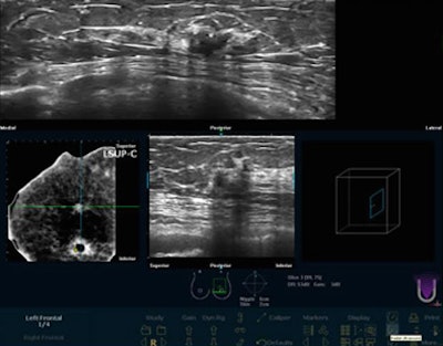 2009 08 31 09 03 40 6 Chang 3viewsbottom