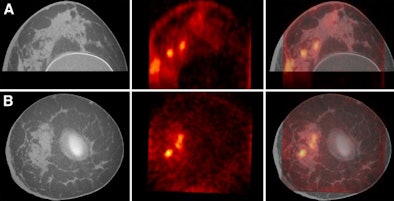 2009 08 31 13 44 32 647 Breast Images 01 394