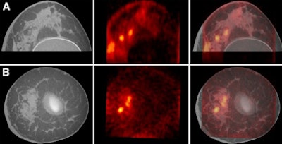 2009 08 31 13 44 32 647 Breast Images 01 394