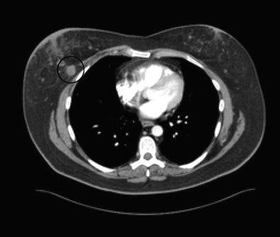 2009 09 01 13 38 11 995 Mendel incidental