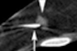 2009 09 01 13 38 13 984 Mendel thumb 08 09