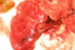 2009 09 10 11 54 53 711 Bioshield thumb 09 09