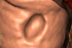 2009 09 15 16 01 56 687 Dachman thumb 09 09
