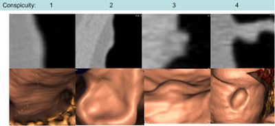 2009 09 15 16 01 58 799 Dachman Table2