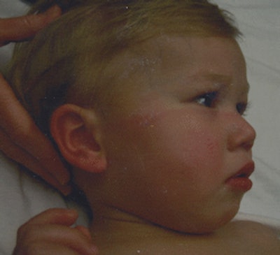 2009 09 18 09 44 41 797 Jacoby Roth Burn 250