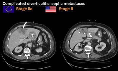 2009 09 22 12 27 39 878 Rogalla complicated septic
