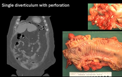 2009 09 22 13 10 31 880 Rogalla airbubble jpg
