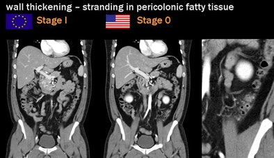 2009 09 22 13 10 32 211 Rogalla wallthicken stranding