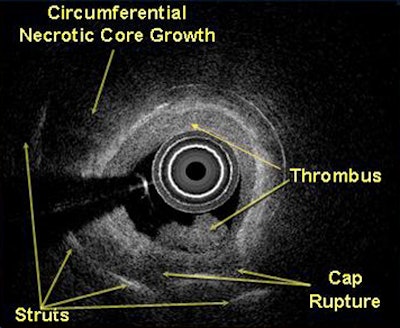 2009 09 25 11 26 50 498 Waxman ivus15mos