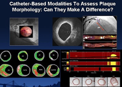 2009 09 25 11 26 59 221 Waxman various modalities