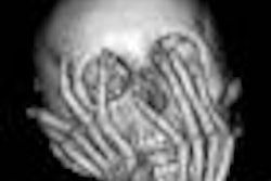 2009 10 02 11 32 58 200 Mummy 70