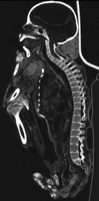 2009 10 02 11 42 13 660 Mummy1 200