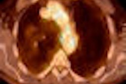 2009 10 05 10 23 54 94 Vascular 01 Mol Ins Thumb