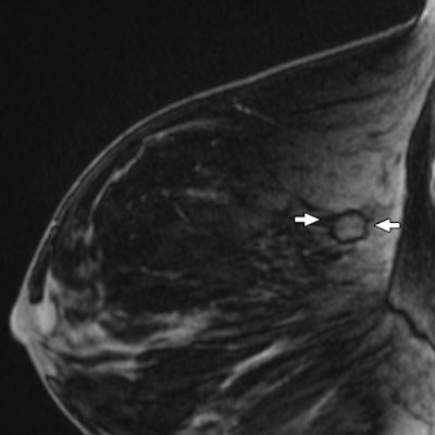 2009 10 05 13 07 24 995 Moy Fig3 C 394