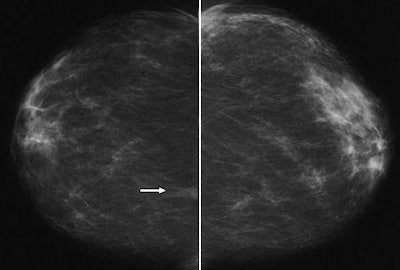 2009 10 05 13 07 25 511 Moy Fig3 Ab 450