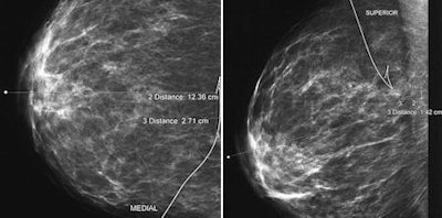 2009 10 05 13 07 26 741 Moy Fig3 De 450