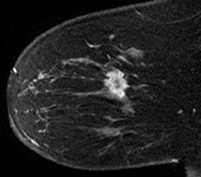 2009 10 05 13 08 14 602 Gutierrez Fig4 394