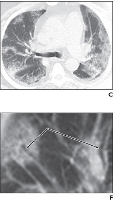 2009 10 13 10 52 33 215 Mollura bottom