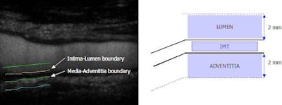 2009 10 19 13 32 21 719 Ceus 2009 10 20 450