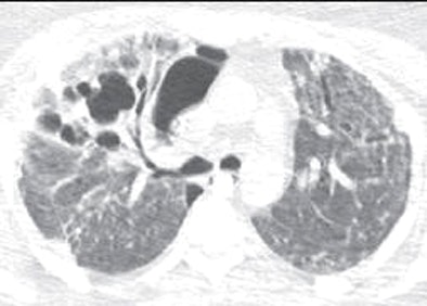 2009 10 20 13 52 02 761 Agarwal 33yearold