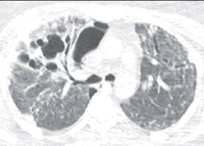 2009 10 20 13 52 02 761 Agarwal 33yearold