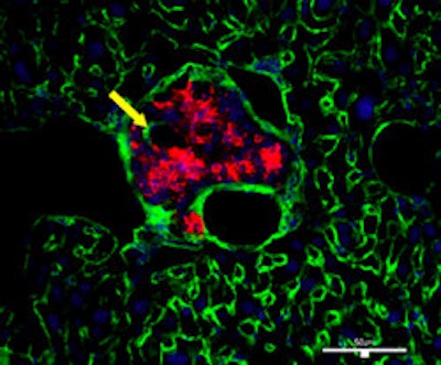 2009 10 23 10 41 52 506 2009 10 29 Ustherapy Middle 250