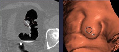 2009 10 28 12 25 59 747 Lawrence polyprevealed bottom