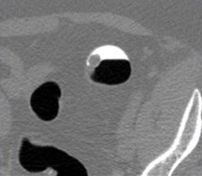 2009 10 28 12 25 59 901 Lawrence polypsummerged top V2