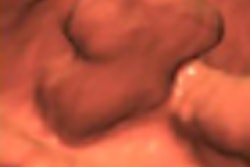 2009 11 02 17 31 03 980 Kim thumb 11 09