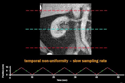 2009 11 05 12 28 27 365 Rogalla nonuniformtop
