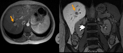 2009 11 05 12 28 31 568 Rogalla fnhtop