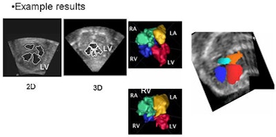 2009 11 05 16 23 40 92 Dindoyal segment results