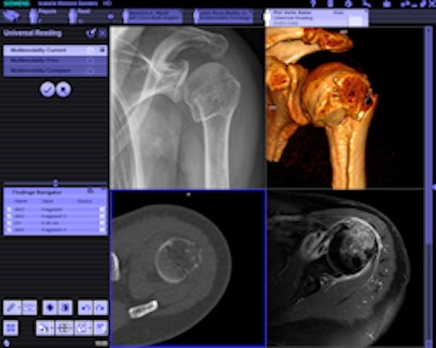 2009 11 23 14 41 41 14 Siemens Syngo via