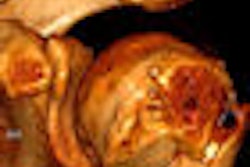 2009 11 23 14 41 44 396 Siemens Syngo via Thumbnail