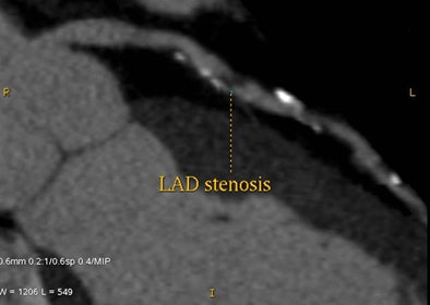 2009 11 24 13 44 05 593 Budoff ladtop