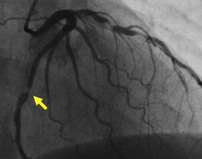 2009 11 24 13 44 07 474 Budoff ladbottom