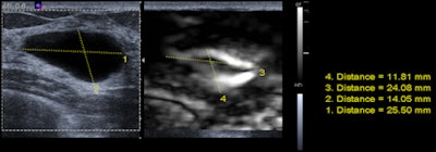 2009 11 29 17 04 44 801 Elasto Destounis Bottom 450